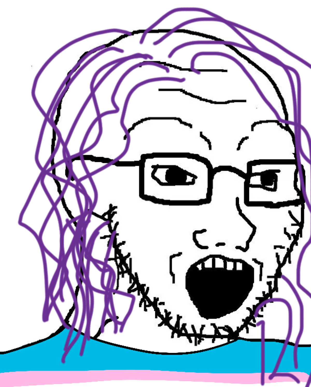 NFT